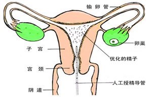 陆军总医院的供卵试管婴儿费用