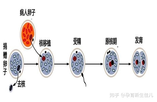 供卵代怀机构取卵后会出现腹水吗？