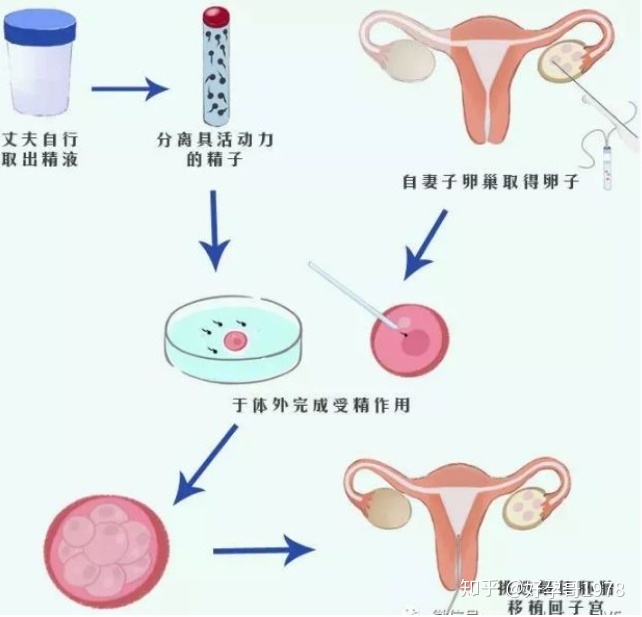 在中信湘雅可以选择性别生男孩吗三代借卵做试管能不能选性别