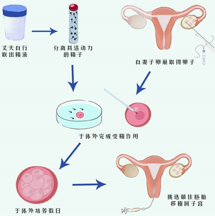 兰州目前有2家生殖医院,哪家试管代怀是否可合法的技术更好+