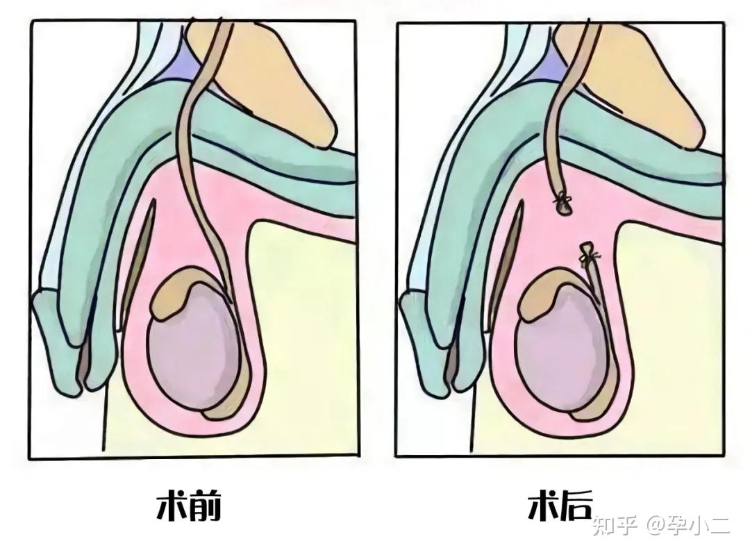 甘肃代怀试管机构10大最佳诊所试管不成功对身体有什么影响