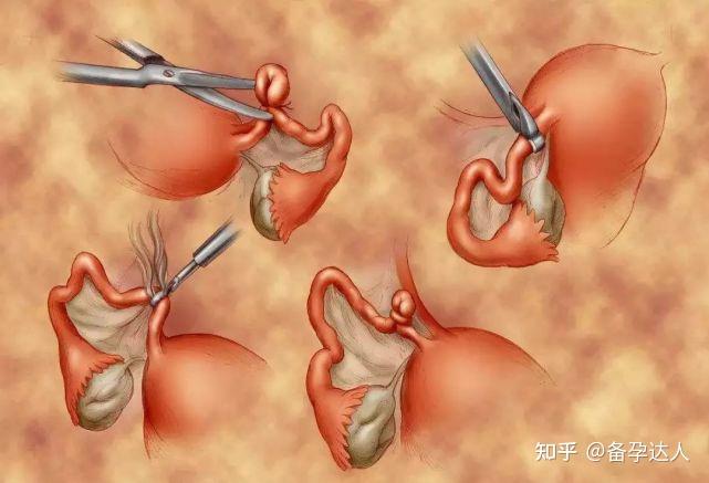「卵子」林志玲喜讯不断,甘肃专家建议34岁前冻卵易中奖!