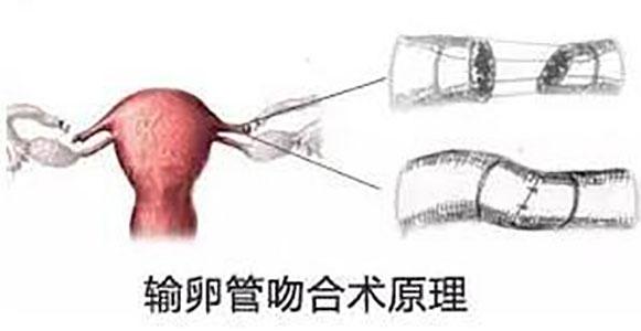 取卵没配成功会通知吗（有取卵3个成功的吗）